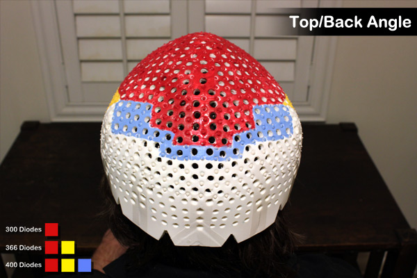 Top/back angle view of a Laser Messiah LLLT device for hair loss on OverMachoGrande's head.